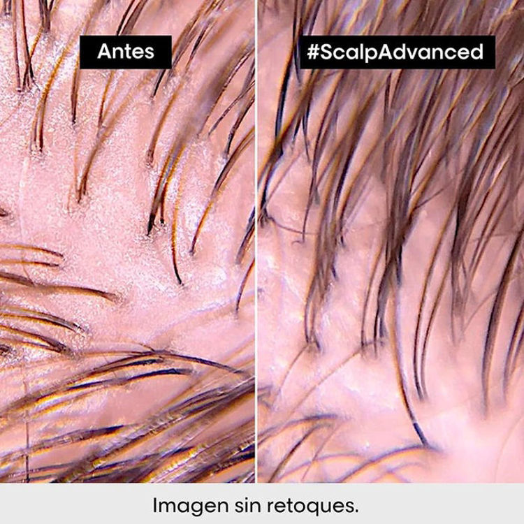 Imagen de L'Oreal Professionnel Serie Expert Scalp Advanced Anti Disconfort Shampoo 500 ml